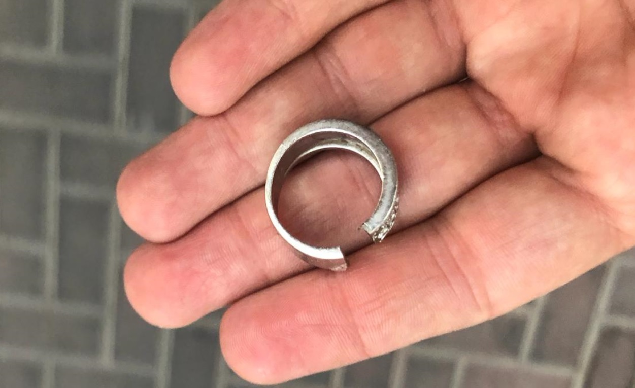 הטבעת שחולצה במבצע מיוחד. צילום: דוברות כיבוי