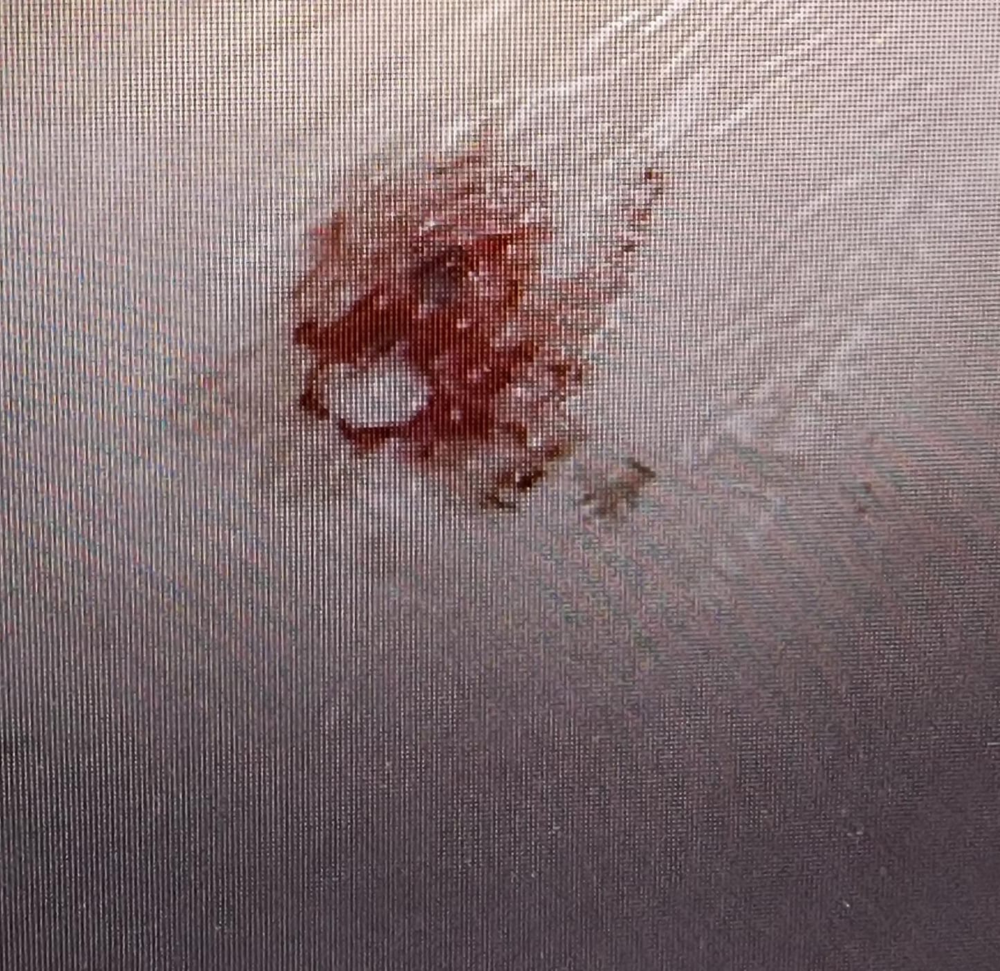 stab womb bb