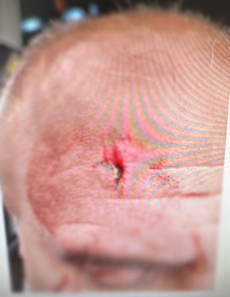 head injory jerus bus driver