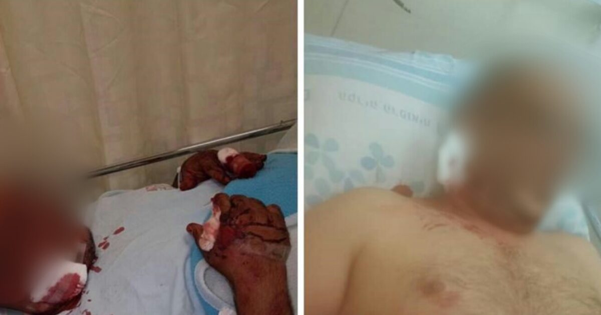 בעל הנגרייה מנשר שהותקף באכזריות. תמונה: פייסבוק בת המשפחה